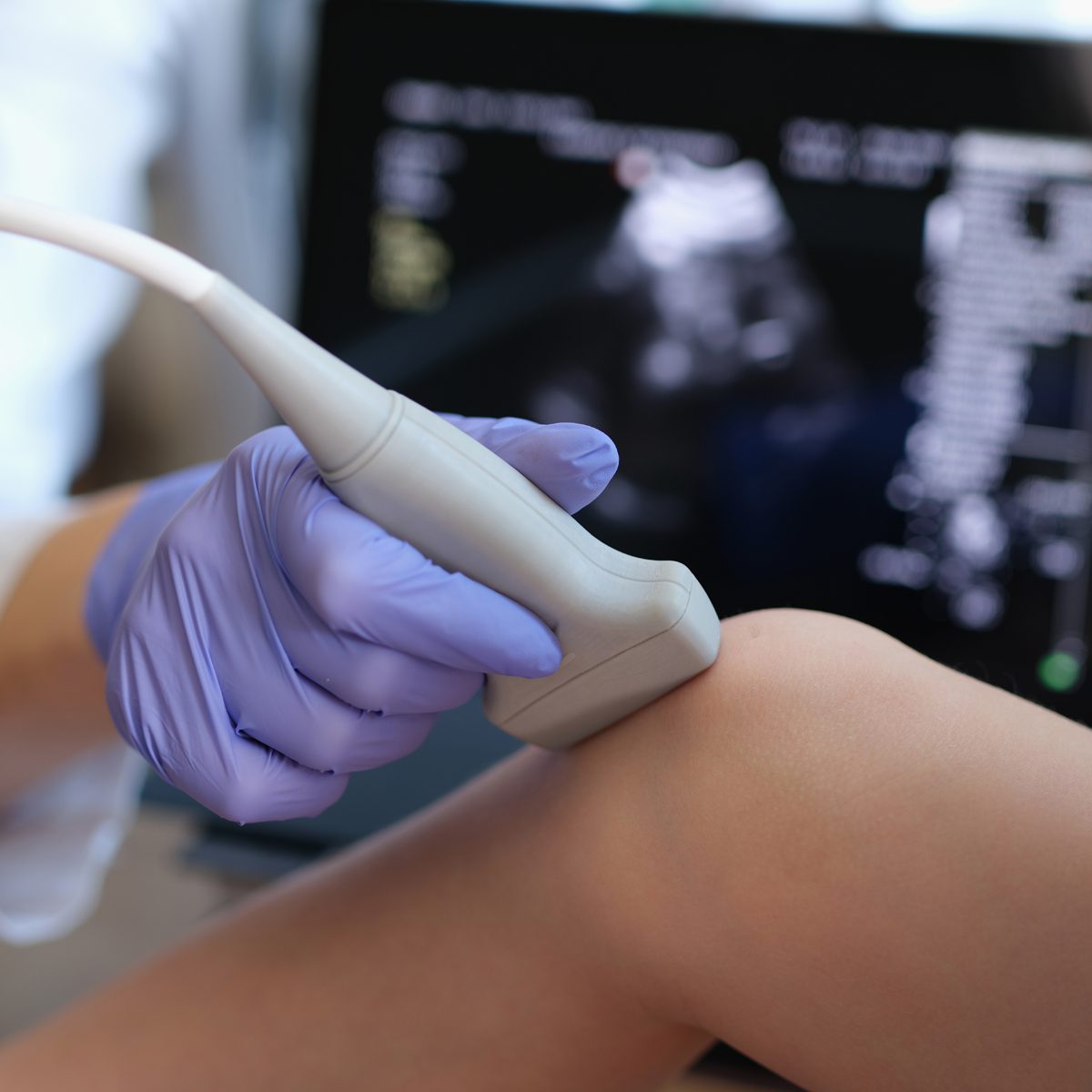 ECOGRAFIA MUSCOLO-SCHELETRICA